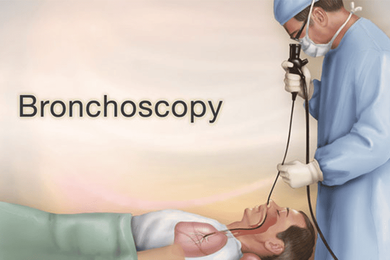 bronchoscopy-treatment