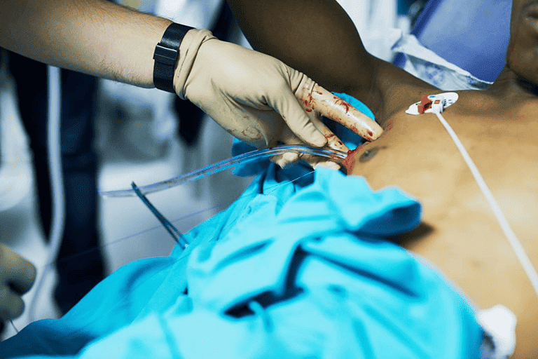 chest-tube-insertion