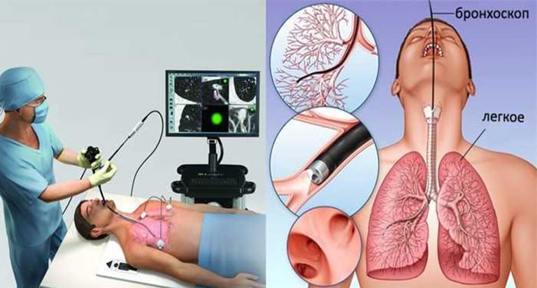 lung-ultrasound-treatmen