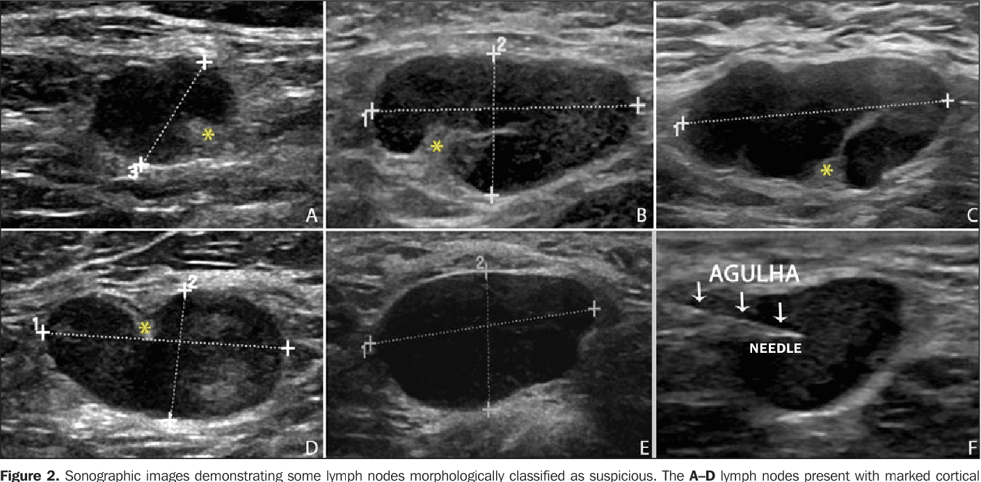lung-ultrasound-treatmen