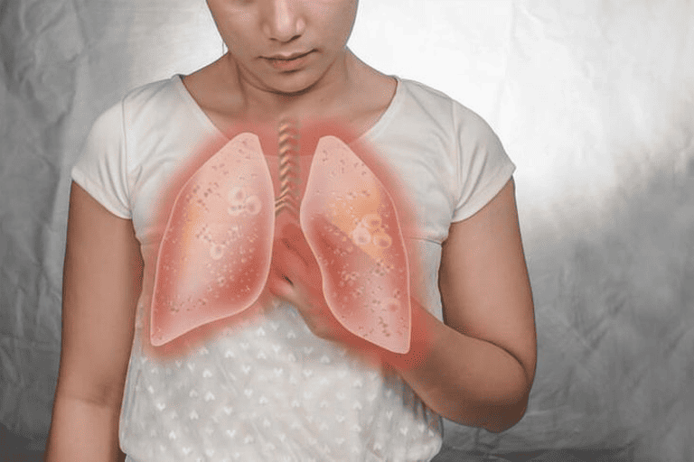 Chest Infection