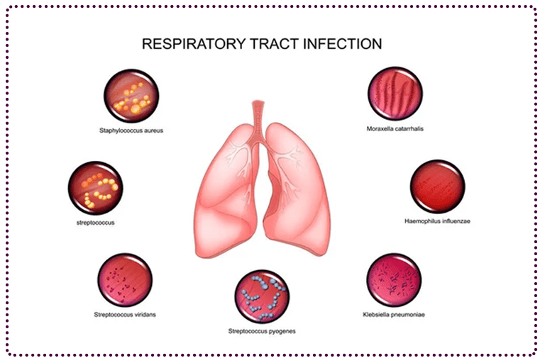 Respiratory Tract Infection